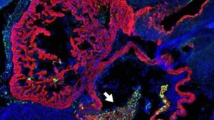 Genwüste steuert die Entwicklung von Embryo und Herz - Hoefner