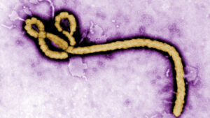 Ebola-Verdachtsfall in Tschechien